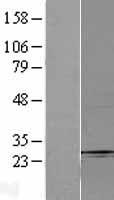 Fbx32 (FBXO32) Human Over-expression Lysate