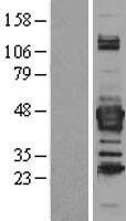 Septin 3 (SEPT3) Human Over-expression Lysate