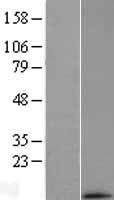 MRPL33 Human Over-expression Lysate