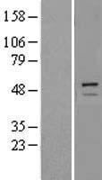 TRIM11 Human Over-expression Lysate