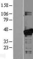 MEK3 (MAP2K3) Human Over-expression Lysate