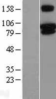 TRPV3 Human Over-expression Lysate