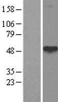 Calreticulin 3 (CALR3) Human Over-expression Lysate