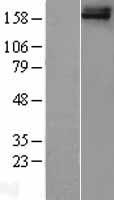 FREM1 Human Over-expression Lysate