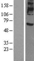 Prominin 2 (PROM2) Human Over-expression Lysate