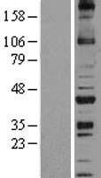 NOXO1 Human Over-expression Lysate