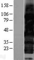 HEXIM2 Human Over-expression Lysate