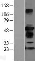 ZFYVE27 Human Over-expression Lysate