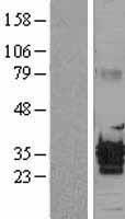 ALKBH3 Human Over-expression Lysate