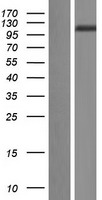 DPP9 Human Over-expression Lysate