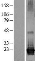 ARL8A Human Over-expression Lysate