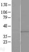GPR146 Human Over-expression Lysate