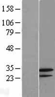 GNPDA2 Human Over-expression Lysate