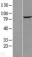 DTX3L Human Over-expression Lysate