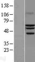 ROR alpha (RORA) Human Over-expression Lysate