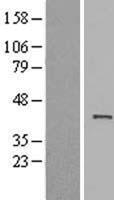 ACTRT1 Human Over-expression Lysate