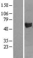 Asparagine synthetase (ASNS) Human Over-expression Lysate