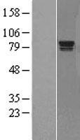 RAD17 Human Over-expression Lysate