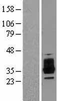 OSCAR Human Over-expression Lysate