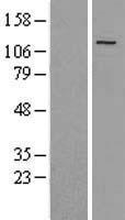 PGC1 beta (PPARGC1B) Human Over-expression Lysate
