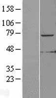 KLHL6 Human Over-expression Lysate