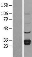 ELMO1 Human Over-expression Lysate