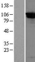 DPP8 Human Over-expression Lysate