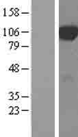 DCBLD2 Human Over-expression Lysate