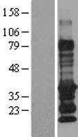 EDARADD Human Over-expression Lysate