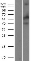 PTGS1 Human Over-expression Lysate