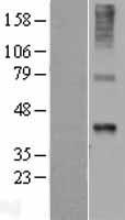 WNT7B Human Over-expression Lysate