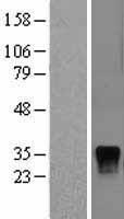DUSP4 Human Over-expression Lysate