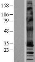MRGPRX4 Human Over-expression Lysate