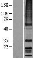 MRGX3 (MRGPRX3) Human Over-expression Lysate