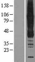 ANKH Human Over-expression Lysate