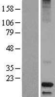 Dermcidin (DCD) Human Over-expression Lysate