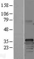 Cyclin D1 (CCND1) Human Over-expression Lysate