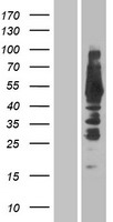 THEM4 Human Over-expression Lysate