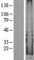 CYYR1 Human Over-expression Lysate