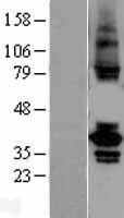 TSSK2 Human Over-expression Lysate