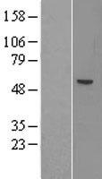 ACSM1 Human Over-expression Lysate