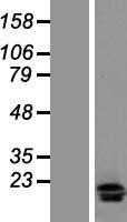 IL17F Human Over-expression Lysate
