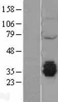 c20orf72 (MGME1) Human Over-expression Lysate