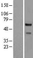 CORO2A Human Over-expression Lysate