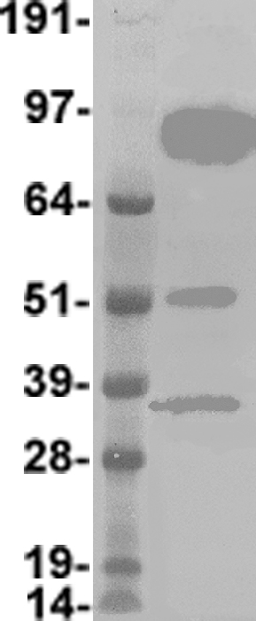 FBXW7 Human Over-expression Lysate