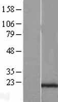 SEC11C Human Over-expression Lysate