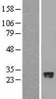 FBXO44 Human Over-expression Lysate