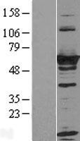 RTKN Human Over-expression Lysate