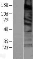 SURF4 Human Over-expression Lysate