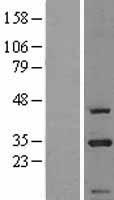 CIP29 (SARNP) Human Over-expression Lysate